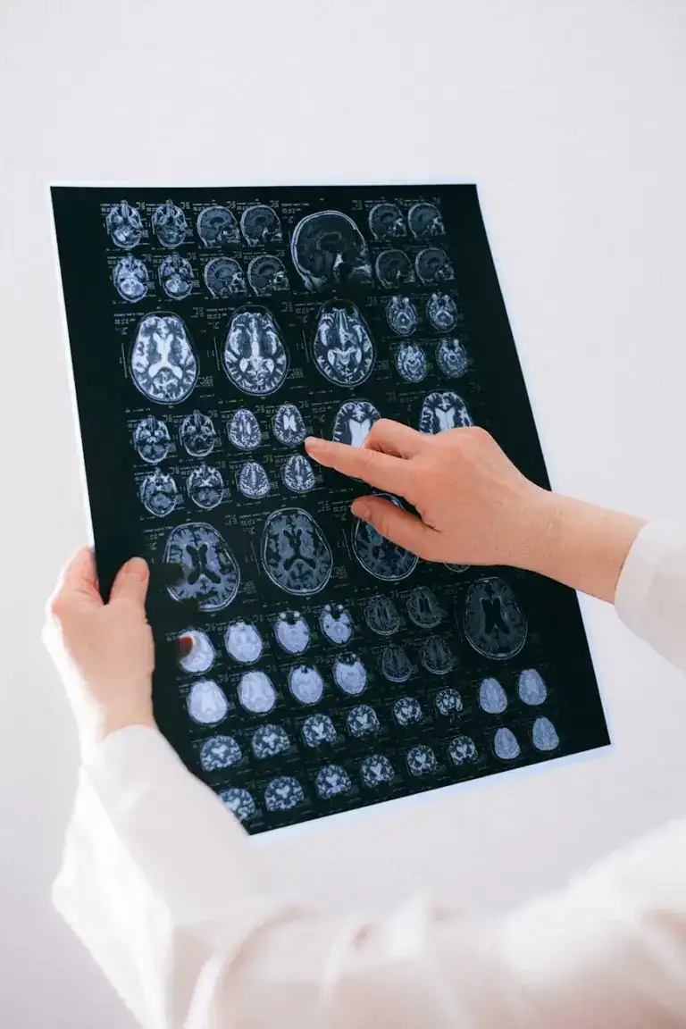 Clinician reviewing brain imaging scans, illustrating the connection between hearing and brain health