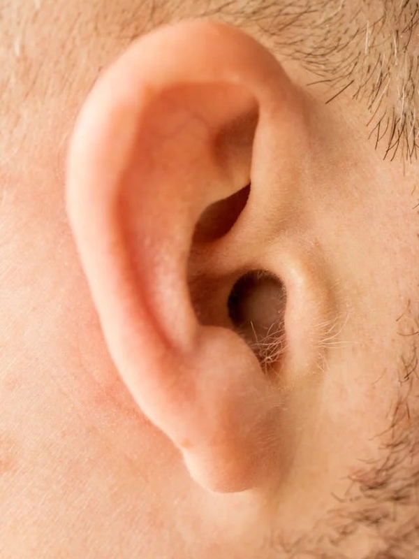 tinnitus treatment